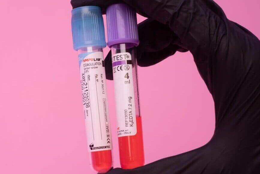 unrecognizable laboratory worker showing blood test tubes